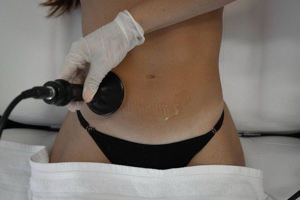 Cavi Lipo in West Village, NYC - Spa Jolie